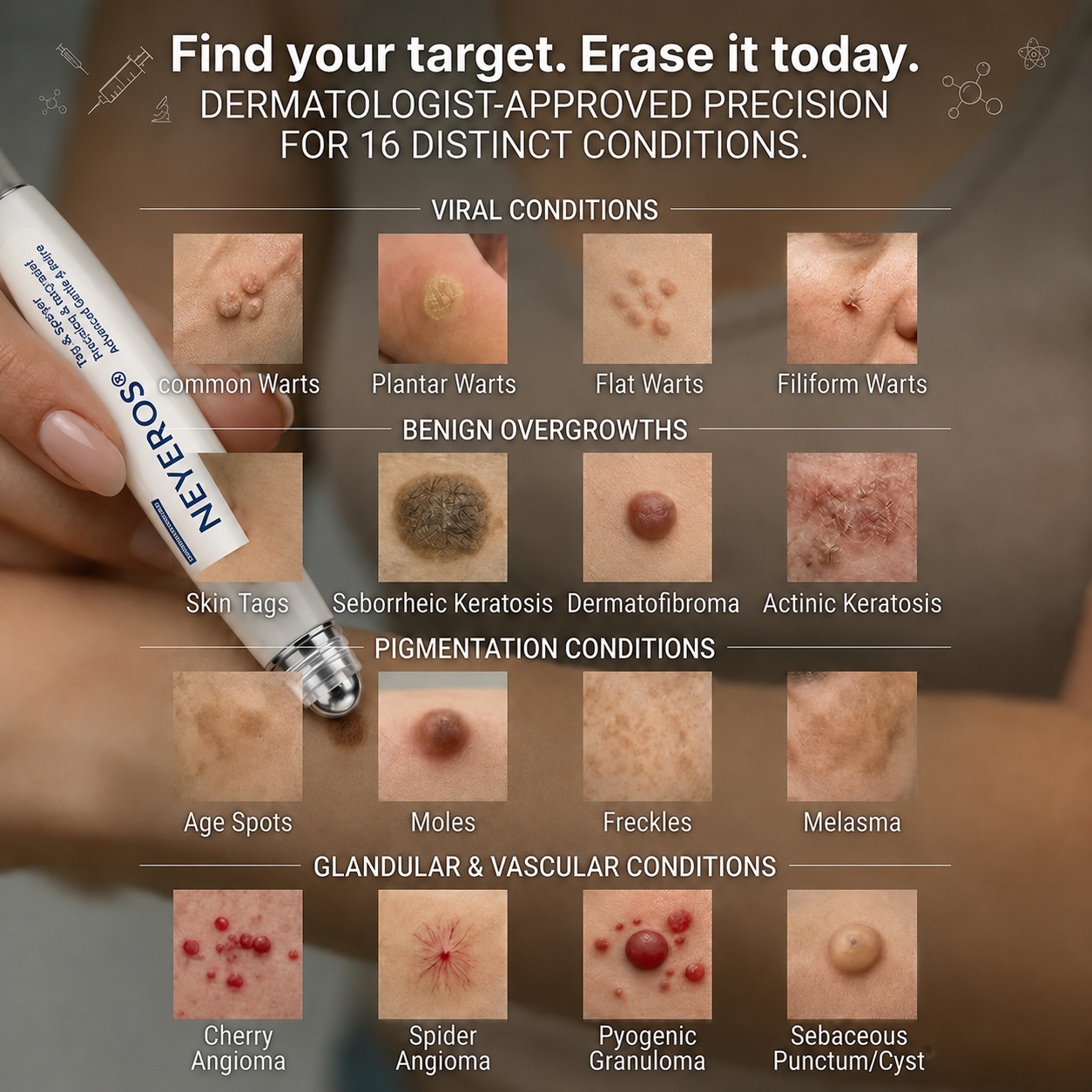 🏥👩‍⚕️NEYEROS®✨ 𝟕-𝐃𝒂𝘆 𝐒𝗸𝐢𝐧 𝐓𝒂𝗴 & 𝐒𝐩𝙤𝐭 𝐄𝐫𝒂𝐬𝙚𝐫 𝐏𝐚𝐢𝐧𝐥𝐞𝐬𝐬 & 𝐒𝐜𝐚𝐫-𝐅𝐫𝐞𝐞 𝐀𝐝𝐯𝐚𝐧𝐜𝐞𝐝 𝐈𝐦𝐩𝐞𝐫𝐟𝐞𝐜𝐭𝐢𝐨𝐧 𝐑𝐞𝐦𝐨𝐯𝐚𝐥 𝐑𝐨𝐥𝐥𝐞𝐫𝐛𝐚𝐥𝐥 𝐏𝐞𝐧