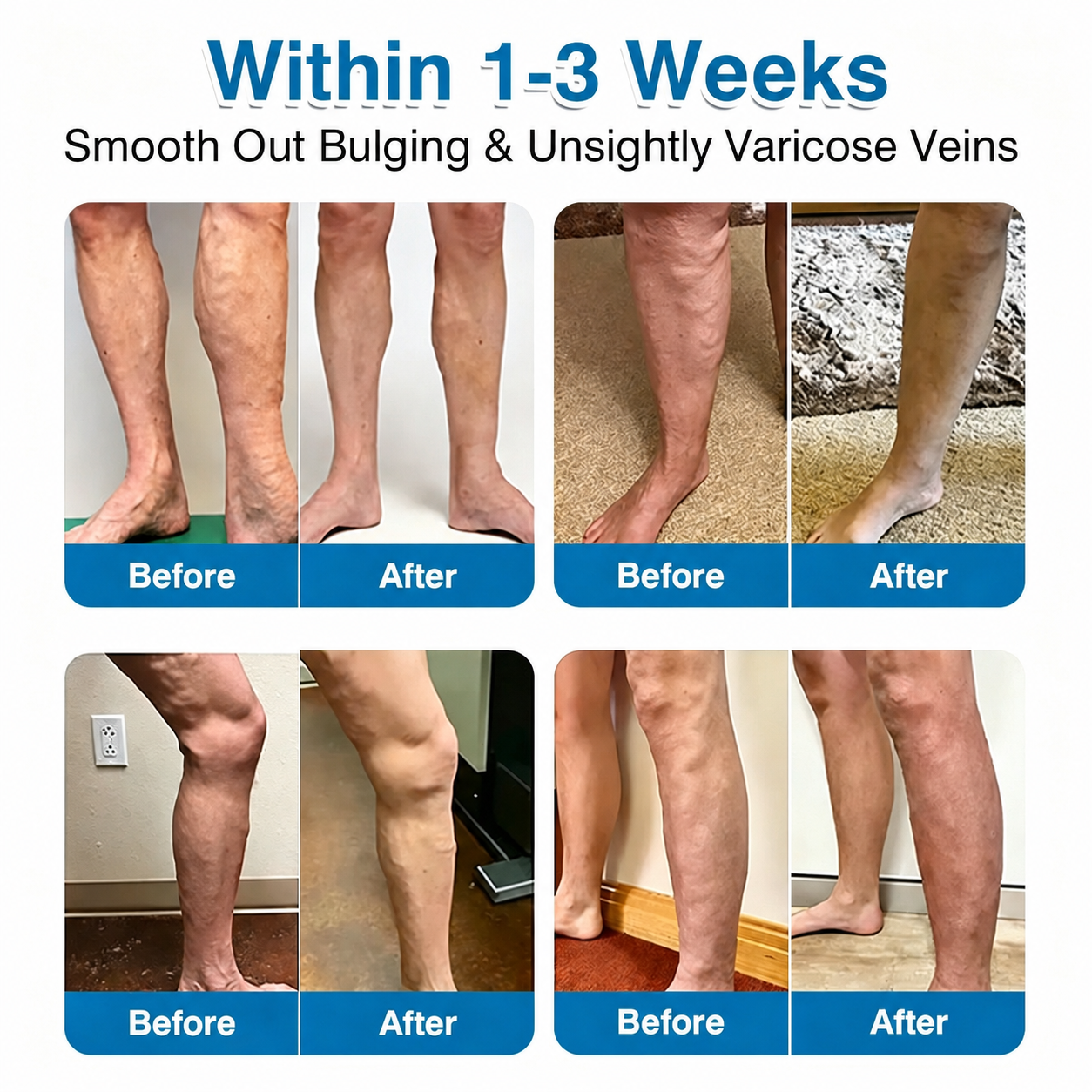 🏅🏃 Microneedle Patch Roll⚡Instant Relief, Long-Term Results✨