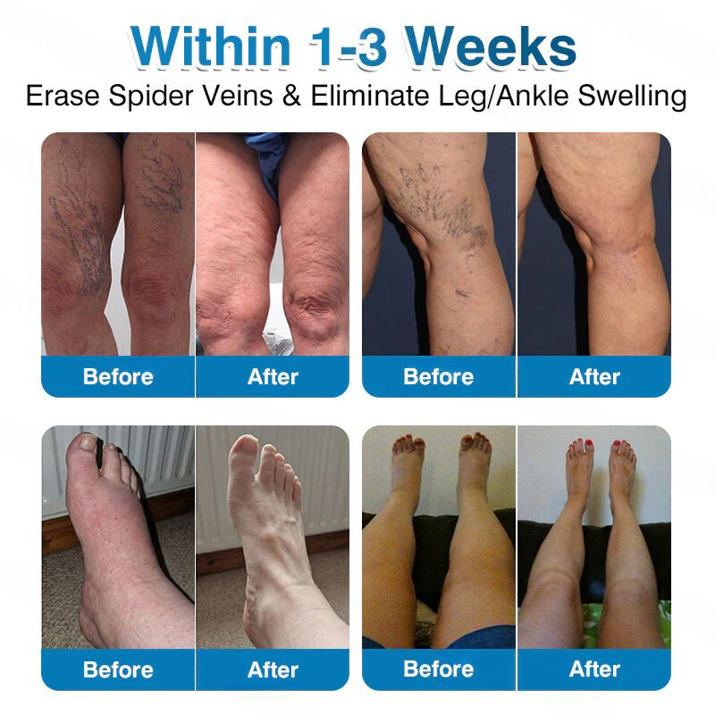 🏅🏃 Microneedle Patch Roll⚡Instant Relief, Long-Term Results✨