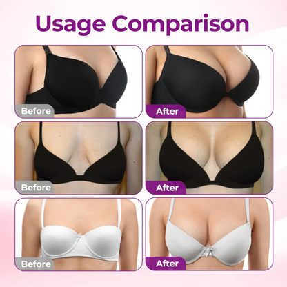 💥 Ultimate Edition, Limited-time Sale 💥Targeted Breast Enhancement Advanced Nano Microneedle Patch