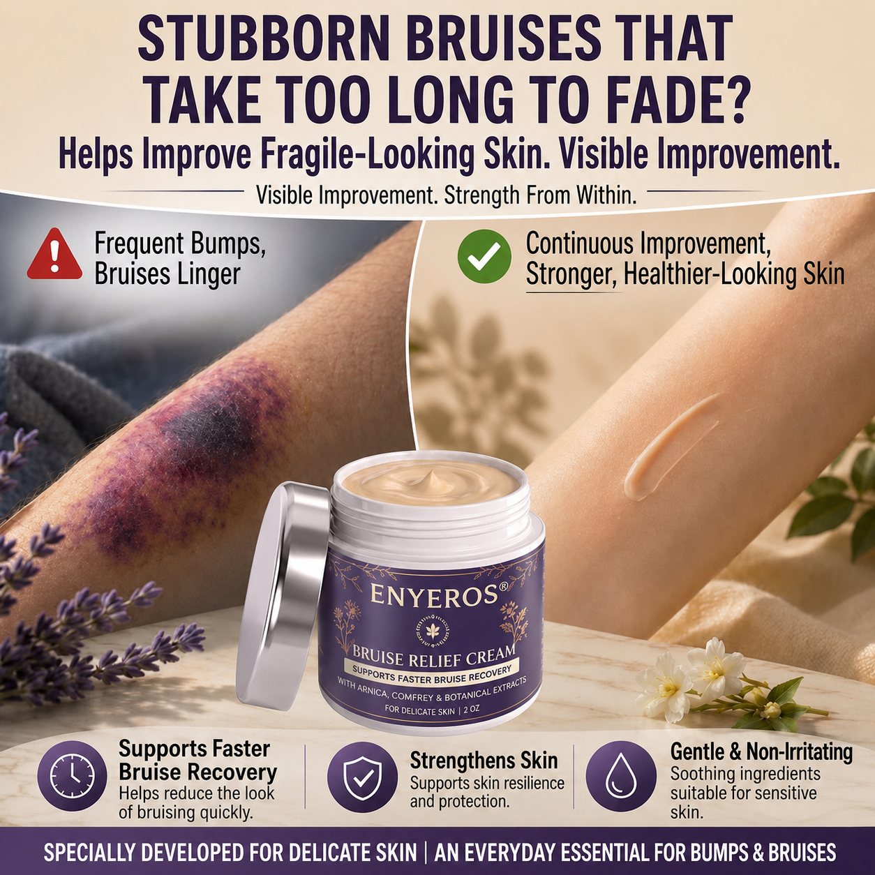 💜 100,000+ UNITS SOLD 💁‍♀️ – ENYEROS® Bruise Relief & Skin-Strengthening Cream